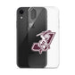 Ziggy’s Sports iPhone Case